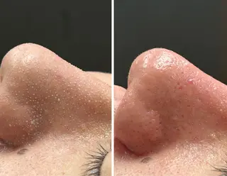 re.make所属・小顔美肌💖痩身☃️ ユキナ🤍のエステ・リラクイメージ