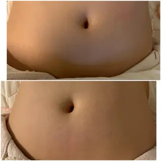 aliaハイフ&水光ジェットサロン所属・aliaハーブ水光店 エステティシャン募集のエステ・リラクイメージ