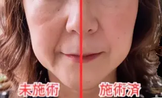 Hisui 種村のエステ・リラクイメージ