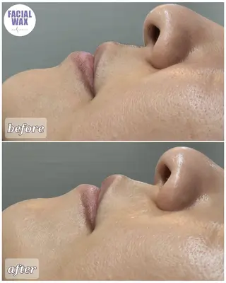 facial salon Lily所属・salon Lilyのエステ・リラクイメージ