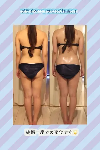 ミディアム カラー パーマ ヘアアレンジ メンズ キッズ ネイル マツエク・マツパ 強圧オールハンド痩身&黄土よもぎ蒸しプライベートサロンClematis池袋所属・強圧オールハンド痩身 片野のエステ・リラクイメージ