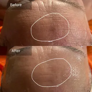 Mandarin Orange所属・毛穴から始める肌メン テマンダリンオレンジのエステ・リラクイメージ