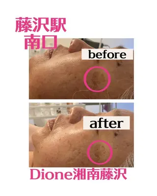 ３歳～フォト美肌脱毛 Dione湘南藤沢店のエステ・リラクイメージ