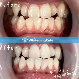 ホワイトニングカフェ徳島沖浜店所属・ホワイトニングカフェ 徳島沖浜店のエステ・リラクイメージ