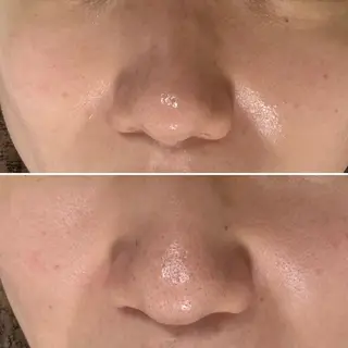 skinity所属・ピーリング専門サロン skinityのエステ・リラクイメージ