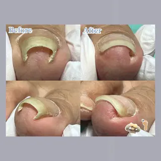 ネイル 巻き爪補正店 大阪天王寺店のネイルデザイン