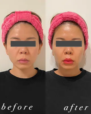 うなじ脱毛/美肌脱毛 LABELのエステ・リラクイメージ