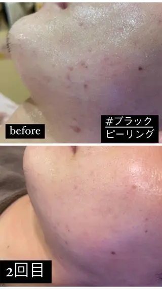 脱毛&まつ毛パーマ Bspaceのエステ・リラクイメージ