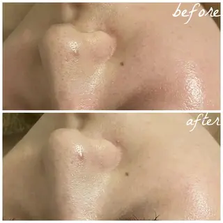 メンズ メナード岐阜茜部 杉浦のエステ・リラクイメージ