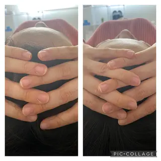 小顔矯正 MEGUMIのエステ・リラクイメージ