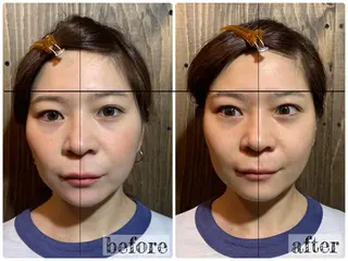 💎後悔させない小顔 矯正💎イトヤマ🌱のエステ・リラクイメージ