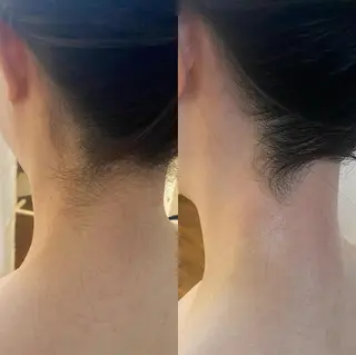 BELCIA福岡店　récolte de BELCIA（レコルトデベルシア）所属・BELCIA福岡店 レコルトデベルシアのエステ・リラクイメージ