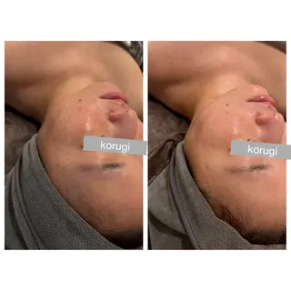 ☆痩身/小顔☆ ハイパーナイフexのエステ・リラクイメージ