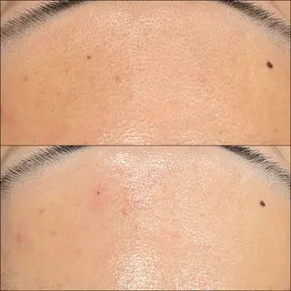 LiZA エステティックサロンのその他イメージ