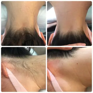 産後/ツヤ肌/子連れ /保育士在籍サロンのエステ・リラクイメージ