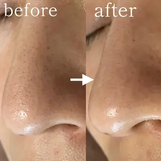 毛穴専門サロン　フルール所属・フルールFululu 自由が丘のエステ・リラクイメージ