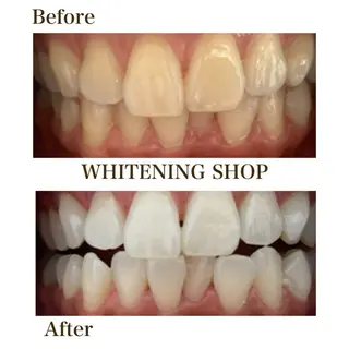 セルフホワイトニングショップ静岡葵区店所属・もえか静岡葵区店ホ ワイトニングショップのその他イメージ