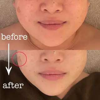 フェイシャル専門店　regalo所属・フェイシャル専門店 regaloのエステ・リラクイメージ