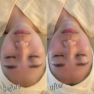 うなじ脱毛/美肌脱毛 LABELのエステ・リラクイメージ