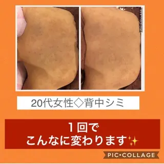 ミディアム パーマ ヘアアレンジ メンズ キッズ ネイル マツエク・マツパ ニキビ・肌質改善専門 ♡人生が変わるサロンのエステ・リラクイメージ