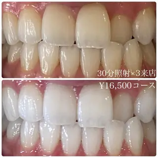 メンズ ホワイトニングルーム　川崎店所属・ホワイトニング ルーム　川崎店のその他イメージ