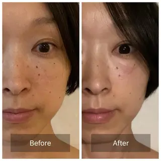 リバースエイジングサロン 縁家所属・川中 佳奈恵のエステ・リラクイメージ