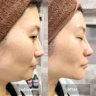 バストアップ専門/デ トックス/小顔コルギのエステ・リラクイメージ