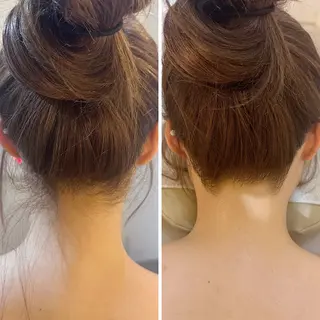 うなじ脱毛/美肌脱毛 LABELのエステ・リラクイメージ