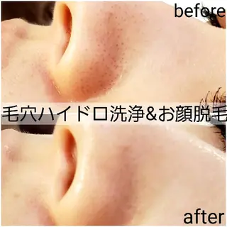 メンズ 小顔・美肌ケア専門 Diva北浜のエステ・リラクイメージ