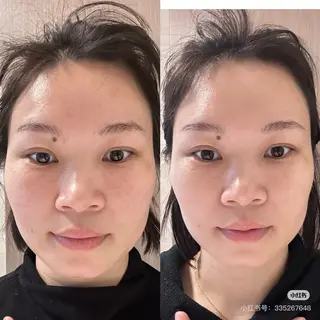 ネイル aliaハイフ&水光ジェットサロン所属・aliaハーブ水光店 エステティシャン募集のエステ・リラクイメージ