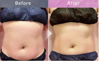 salon de MOREのエステ・リラクイメージ