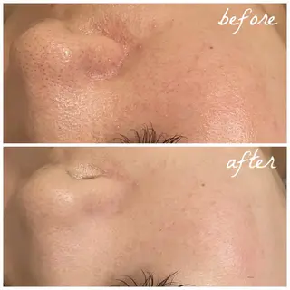 メンズ メナード岐阜市茜部 杉浦のエステ・リラクイメージ