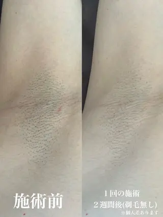 メンズ muumo所属・muumo まりののエステ・リラクイメージ