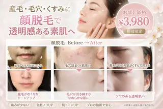 UN・MULAN (大田　瑶子)のマツエク・マツパデザイン