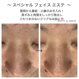 マツエク・マツパ ビューティー ミロワールのエステ・リラクイメージ