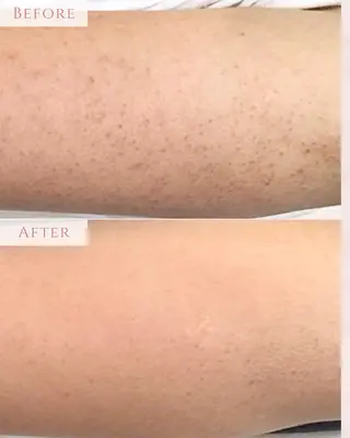 肌質改善専門サロン Bellmi/心斎橋のエステ・リラクイメージ