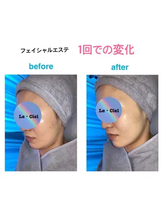 フェイシャルエステLe・Ciel所属・Le・Ciel フェイシャル&ボディのエステ・リラクイメージ