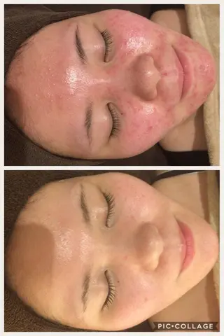 ミディアム カラー パーマ ヘアアレンジ メンズ キッズ ネイル マツエク・マツパ ニキビ・肌質改善専門 ♡人生が変わるサロンのエステ・リラクイメージ