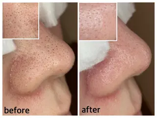 韓国肌管理 【毛穴専科】のエステ・リラクイメージ