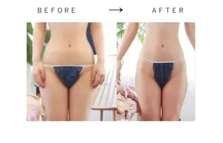 RENsalon大阪 体質改善リトリートのエステ・リラクイメージ