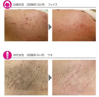 Beauty Salon Charmant所属・富山 千晶のエステ・リラクイメージ