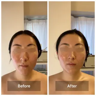 眉毛×小顔矯正サロン パピヨンsakiのエステ・リラクイメージ