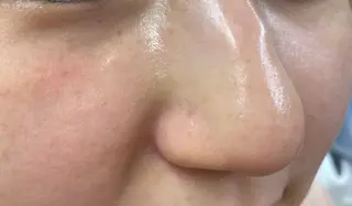 RE:moom リムーム/脱毛エステのエステ・リラクイメージ