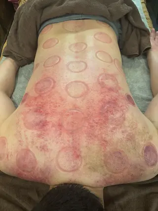 かっさ（刮痧）専門店 心氣院のその他イメージ