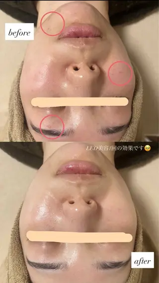 salon More所属・出口 玲菜のエステ・リラクイメージ