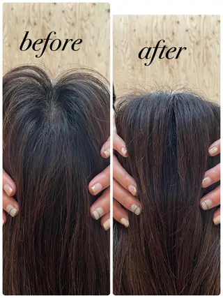 ate'所属・個室ドライヘッドスパ 🍃moriのエステ・リラクイメージ