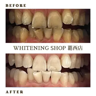 メンズ ホワイトニング ショップ葛西店のその他イメージ