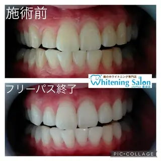 ホワイトニングサロンシフォン豊田店所属・ホワイトニングサロン シフォン豊田店のその他イメージ