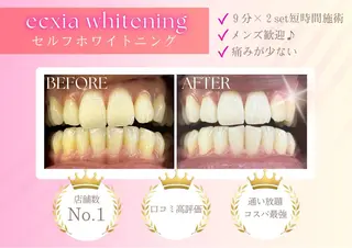 セルフホワイトニングサロン エクシアホワイト西尾店所属・エクシアホワイト西尾 堀内恵のその他イメージ