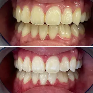 メンズ マツエク・マツパ ホワイトニング ⚓︎CREW柏⚓︎のその他イメージ